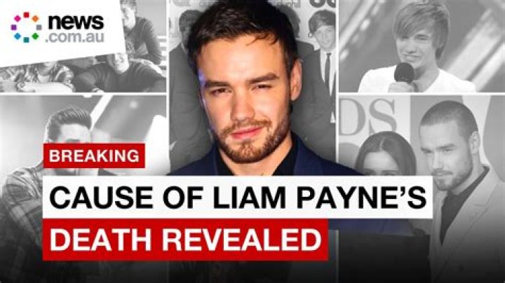 Liam Payne's Journey: The Truth Behind His Jawline Surgery