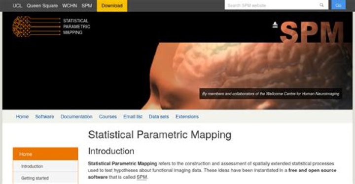 Understanding SPM Age: A Comprehensive Guide to Statistical Parametric Mapping in Neuroimaging